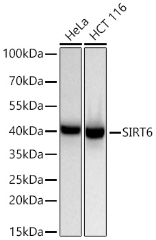 Western blot analysis of various lysates using [KD Validated] SIRT6 Rabbit mAb at 1:1000 dilution incubated overnight at 4℃.|Secondary antibody: HRP-conjugated Goat anti-Rabbit IgG (H+L) at 1:10000 dilution.|Lysates/proteins: 25 μg per lane.|Blocking buffer: 3% nonfat dry milk in TBST.|Detection: ECL Basic Kit.|Exposure time: 20s.