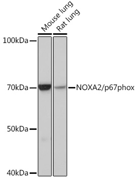 Western blot analysis of various lysates using NOXA2/p67phox Rabbit mAb at 1:1000 dilution.|Secondary antibody: HRP-conjugated Goat anti-Rabbit IgG (H+L) at 1:10000 dilution.|Lysates/proteins: 25μg per lane.|Blocking buffer: 3% nonfat dry milk in TBST.|Detection: ECL Basic Kit.|Exposure time: 30s.