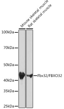 Western blot analysis of various lysates using Fbx32/FBXO32 Rabbit mAb at 1:1000 dilution.|Secondary antibody: HRP-conjugated Goat anti-Rabbit IgG (H+L) at 1:10000 dilution.|Lysates/proteins: 25μg per lane.|Blocking buffer: 3% nonfat dry milk in TBST.|Detection: ECL Basic Kit.|Exposure time: 10s.