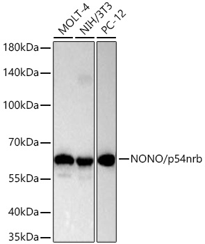 Western blot analysis of various lysates using NONO/p54nrb Rabbit mAb at 1:1000 dilution incubated at room temperature for 1.5 hours.|Secondary antibody: HRP-conjugated Goat anti-Rabbit IgG (H+L) at 1:10000 dilution.|Lysates/proteins: 25 μg per lane.|Blocking buffer: 3% nonfat dry milk in TBST.|Detection: ECL Basic Kit.|Exposure time: 1 s.