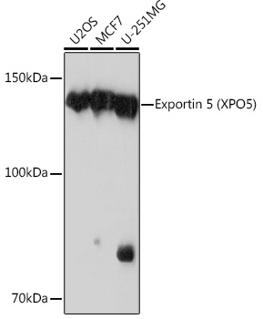 Western blot analysis of various lysates using Exportin 5 (XPO5) (XPO5) Rabbit mAb at 1:1000 dilution.|Secondary antibody: HRP-conjugated Goat anti-Rabbit IgG (H+L) at 1:10000 dilution.|Lysates/proteins: 25μg per lane.|Blocking buffer: 3% nonfat dry milk in TBST.|Detection: ECL Basic Kit.|Exposure time: 30s.