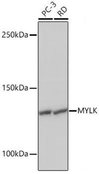 Western blot analysis of various lysates using MYLK Rabbit mAb at 1:1000 dilution.|Secondary antibody: HRP-conjugated Goat anti-Rabbit IgG (H+L) at 1:10000 dilution.|Lysates/proteins: 25μg per lane.|Blocking buffer: 3% nonfat dry milk in TBST.|Detection: ECL Basic Kit.|Exposure time: 1s.