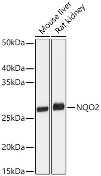 Western blot analysis of various lysates using NQO2 Rabbit mAb at 1:1000 dilution incubated overnight at 4℃.|Secondary antibody: HRP-conjugated Goat anti-Rabbit IgG (H+L) at 1:10000 dilution.|Lysates/proteins: 25 μg per lane.|Blocking buffer: 3% nonfat dry milk in TBST.|Detection: ECL Basic Kit.|Exposure time: 3s.