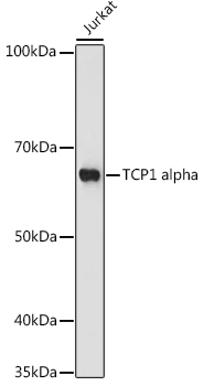 Western blot analysis of lysates from Jurkat cells, using TCP1 alpha Rabbit mAb at 1:1000 dilution.|Secondary antibody: HRP-conjugated Goat anti-Rabbit IgG (H+L) at 1:10000 dilution.|Lysates/proteins: 25μg per lane.|Blocking buffer: 3% nonfat dry milk in TBST.|Detection: ECL Basic Kit.|Exposure time: 180s.