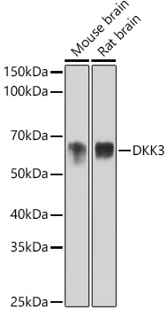 Western blot analysis of various lysates using DKK3 Rabbit mAb at 1:1000 dilution.|Secondary antibody: HRP-conjugated Goat anti-Rabbit IgG (H+L) at 1:10000 dilution.|Lysates/proteins: 25μg per lane.|Blocking buffer: 3% nonfat dry milk in TBST.|Detection: ECL Basic Kit.|Exposure time: 60s.