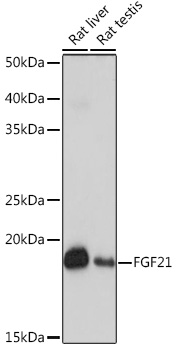 Western blot analysis of various lysates using FGF21 Rabbit mAb at 1:1000 dilution.|Secondary antibody: HRP-conjugated Goat anti-Rabbit IgG (H+L) at 1:10000 dilution.|Lysates/proteins: 25μg per lane.|Blocking buffer: 3% nonfat dry milk in TBST.|Detection: ECL Basic Kit.|Exposure time: 1s.