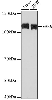 Western blot analysis of various lysates using ERK5 Rabbit mAb at 1:500 dilution.|Secondary antibody: HRP-conjugated Goat anti-Rabbit IgG (H+L) at 1:10000 dilution.|Lysates/proteins: 25 μg per lane.|Blocking buffer: 3% nonfat dry milk in TBST.|Detection: ECL Basic Kit.|Exposure time: 180 s.