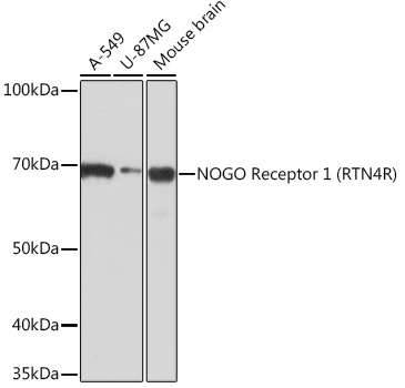 Western blot analysis of various lysates using NOGO Receptor 1 (RTN4R) Rabbit mAb at 1:1000 dilution.|Secondary antibody: HRP-conjugated Goat anti-Rabbit IgG (H+L) at 1:10000 dilution.|Lysates/proteins: 25μg per lane.|Blocking buffer: 3% nonfat dry milk in TBST.|Detection: ECL Basic Kit.|Exposure time: 3min.