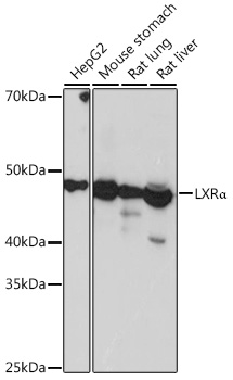 Western blot analysis of various lysates using LXRα Rabbit mAb at 1:1000 dilution.|Secondary antibody: HRP-conjugated Goat anti-Rabbit IgG (H+L) at 1:10000 dilution.|Lysates/proteins: 25μg per lane.|Blocking buffer: 3% nonfat dry milk in TBST.|Detection: ECL Basic Kit.|Exposure time: 3s.