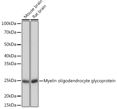 Western blot analysis of various lysates using Myelin oligodendrocyte glycoprotein Rabbit mAb at 1:1000 dilution.|Secondary antibody: HRP-conjugated Goat anti-Rabbit IgG (H+L) at 1:10000 dilution.|Lysates/proteins: 25μg per lane.|Blocking buffer: 3% nonfat dry milk in TBST.|Detection: ECL Basic Kit.|Exposure time: 10s.