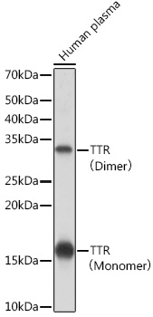 Western blot analysis of lysates from Human plasma, using TTR Rabbit mAb at 1:1000 dilution.|Secondary antibody: HRP-conjugated Goat anti-Rabbit IgG (H+L) at 1:10000 dilution.|Lysates/proteins: 25μg per lane.|Blocking buffer: 3% nonfat dry milk in TBST.|Detection: ECL Basic Kit.|Exposure time: 1s.
