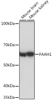 Western blot analysis of various lysates using FAAH1 Rabbit mAb at 1:1000 dilution.|Secondary antibody: HRP-conjugated Goat anti-Rabbit IgG (H+L) at 1:10000 dilution.|Lysates/proteins: 25μg per lane.|Blocking buffer: 3% nonfat dry milk in TBST.|Detection: ECL Basic Kit.|Exposure time: 1s.