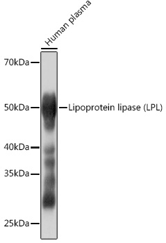 Western blot analysis of lysates from Human plasma, using Lipoprotein lipase (LPL) (LPL) Rabbit mAb at 1:1000 dilution.|Secondary antibody: HRP-conjugated Goat anti-Rabbit IgG (H+L) at 1:10000 dilution.|Lysates/proteins: 25μg per lane.|Blocking buffer: 3% nonfat dry milk in TBST.|Detection: ECL Basic Kit.|Exposure time: 3s.