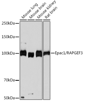 Western blot analysis of various lysates using Epac1/RAPGEF3 Rabbit mAb at 1:1000 dilution.|Secondary antibody: HRP-conjugated Goat anti-Rabbit IgG (H+L) at 1:10000 dilution.|Lysates/proteins: 25μg per lane.|Blocking buffer: 3% nonfat dry milk in TBST.|Detection: ECL Basic Kit.|Exposure time: 60s.