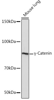 Western blot analysis of lysates from Mouse lung, using γ-Catenin Rabbit mAb at 1:1000 dilution..|Secondary antibody: HRP-conjugated Goat anti-Rabbit IgG (H+L) at 1:10000 dilution.|Lysates/proteins: 25μg per lane.|Blocking buffer: 3% nonfat dry milk in TBST.|Detection: ECL Basic Kit.|Exposure time: 5s.