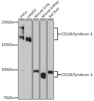 Western blot analysis of various lysates using Syndecan 1 Rabbit mAb at 1:1000 dilution.|Secondary antibody: HRP-conjugated Goat anti-Rabbit IgG (H+L) at 1:10000 dilution.|Lysates/proteins: 25μg per lane.|Blocking buffer: 3% nonfat dry milk in TBST.|Detection: ECL Basic Kit.|Exposure time: 90s.