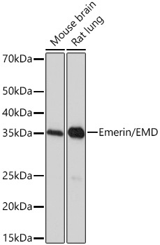Western blot analysis of various lysates using Emerin/EMD Rabbit mAb at 1:1000 dilution.|Secondary antibody: HRP-conjugated Goat anti-Rabbit IgG (H+L) at 1:10000 dilution.|Lysates/proteins: 25μg per lane.|Blocking buffer: 3% nonfat dry milk in TBST.|Detection: ECL Basic Kit.|Exposure time: 90s.