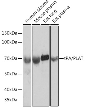 Western blot analysis of various lysates using tPA/tPA/PLAT Rabbit mAb at 1:1000 dilution.|Secondary antibody: HRP-conjugated Goat anti-Rabbit IgG (H+L) at 1:10000 dilution.|Lysates/proteins: 25μg per lane.|Blocking buffer: 3% nonfat dry milk in TBST.|Detection: ECL Basic Kit.|Exposure time: 10s.