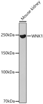 Western blot analysis of lysates from Mouse kidney, using WNK1 Rabbit mAb at 1:1000 dilution.|Secondary antibody: HRP-conjugated Goat anti-Rabbit IgG (H+L) at 1:10000 dilution.|Lysates/proteins: 25μg per lane.|Blocking buffer: 3% nonfat dry milk in TBST.|Detection: ECL Basic Kit.|Exposure time: 3min.