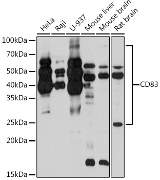 Western blot analysis of various lysates using CD83 Rabbit mAb at 1:1000 dilution.|Secondary antibody: HRP-conjugated Goat anti-Rabbit IgG (H+L) at 1:10000 dilution.|Lysates/proteins: 25μg per lane.|Blocking buffer: 3% nonfat dry milk in TBST.|Detection: ECL Basic Kit.|Exposure time: 3min.