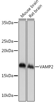 Western blot analysis of various lysates using VAMP2 Rabbit mAb at 1:1000 dilution.|Secondary antibody: HRP-conjugated Goat anti-Rabbit IgG (H+L) at 1:10000 dilution.|Lysates/proteins: 25μg per lane.|Blocking buffer: 3% nonfat dry milk in TBST.|Detection: ECL Basic Kit.|Exposure time: 1s.
