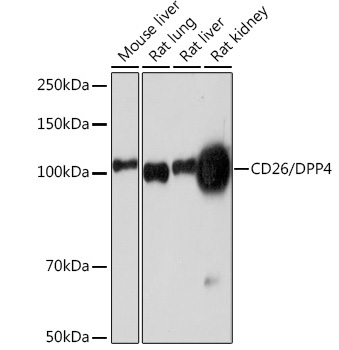 Western blot analysis of various lysates using CD26/DPP4 Rabbit mAb at 1:1000 dilution.|Secondary antibody: HRP-conjugated Goat anti-Rabbit IgG (H+L) at 1:10000 dilution.|Lysates/proteins: 25μg per lane.|Blocking buffer: 3% nonfat dry milk in TBST.|Detection: ECL Enhanced Kit.|Exposure time: 3min.