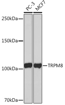 Western blot analysis of various lysates using TRPM8  Rabbit mAb at 1:1000 dilution.|Secondary antibody: HRP-conjugated Goat anti-Rabbit IgG (H+L) at 1:10000 dilution.|Lysates/proteins: 25μg per lane.|Blocking buffer: 3% nonfat dry milk in TBST.|Detection: ECL Basic Kit.|Exposure time: 3min.