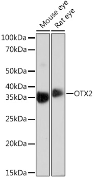 Western blot analysis of various lysates using OTX2 Rabbit mAb at 1:1000 dilution.|Secondary antibody: HRP-conjugated Goat anti-Rabbit IgG (H+L) at 1:10000 dilution.|Lysates/proteins: 25μg per lane.|Blocking buffer: 3% nonfat dry milk in TBST.|Detection: ECL Basic Kit.|Exposure time: 90s.