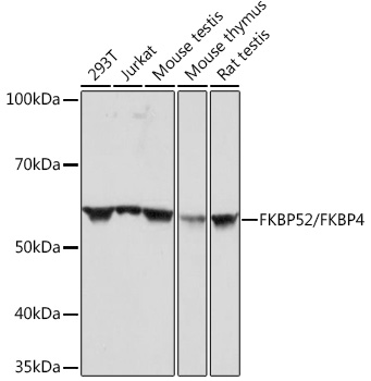 Western blot analysis of various lysates using FKBP52/FKBP4 Rabbit mAb at 1:1000 dilution.|Secondary antibody: HRP-conjugated Goat anti-Rabbit IgG (H+L) at 1:10000 dilution.|Lysates/proteins: 25μg per lane.|Blocking buffer: 3% nonfat dry milk in TBST.|Detection: ECL Basic Kit.|Exposure time: 60s.