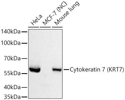 Western blot analysis of various lysates using Cytokeratin 7 (KRT7) Rabbit mAbat 1:20000 dilution incubated at room temperature for 1.5 hours.|Secondary antibody: HRP-conjugated Goat anti-Rabbit IgG (H+L) at 1:10000 dilution.|Lysates/proteins: 25 μg per lane.|Blocking buffer: 3% nonfat dry milk in TBST.|Detection: ECL Basic Kit.|Negative control (NC): MCF-7|Exposure time: 1s.