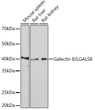 Western blot analysis of various lysates using Galectin 8/LGALS8Rabbit mAb at 1:1000 dilution.|Secondary antibody: HRP-conjugated Goat anti-Rabbit IgG (H+L) at 1:10000 dilution.|Lysates/proteins: 25μg per lane.|Blocking buffer: 3% nonfat dry milk in TBST.|Detection: ECL Basic Kit.|Exposure time: 3min.