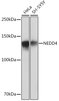 Western blot analysis of various lysates using NEDD4 Rabbit mAb at 1:1000 dilution.|Secondary antibody: HRP-conjugated Goat anti-Rabbit IgG (H+L) at 1:10000 dilution.|Lysates/proteins: 25μg per lane.|Blocking buffer: 3% nonfat dry milk in TBST.|Detection: ECL Basic Kit.|Exposure time: 1s.