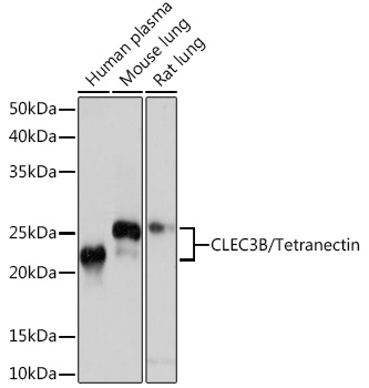 Western blot analysis of various lysates using CLEC3B/CLEC3B/Tetranectin Rabbit mAb at 1:1000 dilution.|Secondary antibody: HRP-conjugated Goat anti-Rabbit IgG (H+L) at 1:10000 dilution.|Lysates/proteins: 25μg per lane.|Blocking buffer: 3% nonfat dry milk in TBST.|Detection: ECL Basic Kit.|Exposure time: 10s.