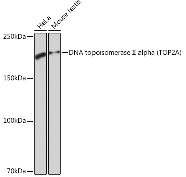 Western blot analysis of various lysates using DNA DNA topoisomerase II alpha (TOP2A) Rabbit mAb at 1:1000 dilution.|Secondary antibody: HRP-conjugated Goat anti-Rabbit IgG (H+L) at 1:10000 dilution.|Lysates/proteins: 25μg per lane.|Blocking buffer: 3% nonfat dry milk in TBST.|Detection: ECL Basic Kit.|Exposure time: 3s.