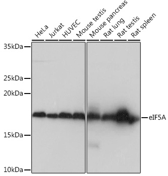 Western blot analysis of various lysates using eIF5A Rabbit mAb at 1:1000 dilution.|Secondary antibody: HRP-conjugated Goat anti-Rabbit IgG (H+L) at 1:10000 dilution.|Lysates/proteins: 25μg per lane.|Blocking buffer: 3% nonfat dry milk in TBST.|Detection: ECL Basic Kit.|Exposure time: 1s.