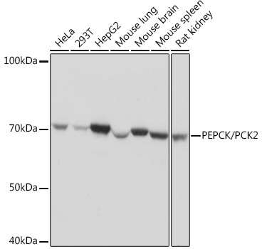 Western blot analysis of various lysates using PEPCK/PEPCK/PCK2 Rabbit mAb at 1:1000 dilution.|Secondary antibody: HRP-conjugated Goat anti-Rabbit IgG (H+L) at 1:10000 dilution.|Lysates/proteins: 25μg per lane.|Blocking buffer: 3% nonfat dry milk in TBST.|Detection: ECL Basic Kit.|Exposure time: 1s.