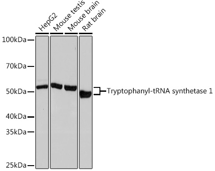 Western blot analysis of various lysates using Tryptophanyl-tRNA synthetase 1 Rabbit mAb at 1:1000 dilution.|Secondary antibody: HRP-conjugated Goat anti-Rabbit IgG (H+L) at 1:10000 dilution.|Lysates/proteins: 25μg per lane.|Blocking buffer: 3% nonfat dry milk in TBST.|Detection: ECL Basic Kit.|Exposure time: 10s.