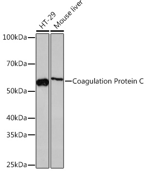 Western blot analysis of various lysates using Coagulation Coagulation Protein C Rabbit mAb at 1:1000 dilution.|Secondary antibody: HRP-conjugated Goat anti-Rabbit IgG (H+L) at 1:10000 dilution.|Lysates/proteins: 25μg per lane.|Blocking buffer: 3% nonfat dry milk in TBST.|Detection: ECL Basic Kit.|Exposure time: 3min.