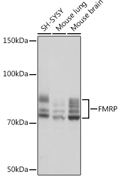 Western blot analysis of various lysates using FMRP Rabbit mAb at 1:1000 dilution.|Secondary antibody: HRP-conjugated Goat anti-Rabbit IgG (H+L) at 1:10000 dilution.|Lysates/proteins: 25μg per lane.|Blocking buffer: 3% nonfat dry milk in TBST.|Detection: ECL Basic Kit.|Exposure time: 1s.
