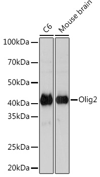Western blot analysis of various lysates using Olig2 Rabbit mAb at 1:1000 dilution.|Secondary antibody: HRP-conjugated Goat anti-Rabbit IgG (H+L) at 1:10000 dilution.|Lysates/proteins: 25μg per lane.|Blocking buffer: 3% nonfat dry milk in TBST.|Detection: ECL Basic Kit.|Exposure time: 3min.