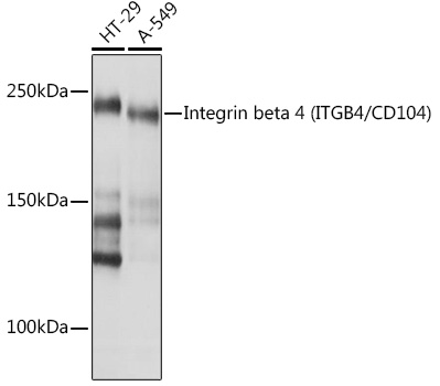 Western blot analysis of various lysates using Integrin beta 4 (ITGB4/CD104) Rabbit mAb at 1:1000 dilution.|Secondary antibody: HRP-conjugated Goat anti-Rabbit IgG (H+L) at 1:10000 dilution.|Lysates/proteins: 25μg per lane.|Blocking buffer: 3% nonfat dry milk in TBST.|Detection: ECL Basic Kit.|Exposure time: 10s.