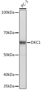 Western blot analysis of lysates from PC-3 cells, using DKC1 Rabbit mAb at 1:1000 dilution.|Secondary antibody: HRP-conjugated Goat anti-Rabbit IgG (H+L) at 1:10000 dilution.|Lysates/proteins: 25μg per lane.|Blocking buffer: 3% nonfat dry milk in TBST.|Detection: ECL Basic Kit.|Exposure time: 1s.