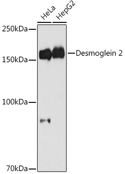 Western blot analysis of various lysates using Desmoglein 2 Rabbit mAb at 1:1000 dilution.|Secondary antibody: HRP-conjugated Goat anti-Rabbit IgG (H+L) at 1:10000 dilution.|Lysates/proteins: 25μg per lane.|Blocking buffer: 3% nonfat dry milk in TBST.|Detection: ECL Basic Kit.|Exposure time: 90s.