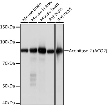 Western blot analysis of various lysates, using Aconitase 2 Rabbit mAb at 1:1000 dilution.|Secondary antibody: HRP-conjugated Goat anti-Rabbit IgG (H+L) at 1:10000 dilution.|Lysates/proteins: 25μg per lane.|Blocking buffer: 3% nonfat dry milk in TBST.|Detection: ECL Basic Kit.|Exposure time: 1s.