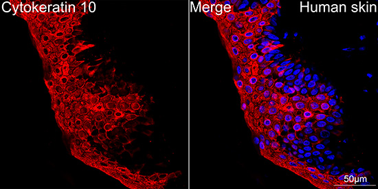 Confocal imaging of paraffin-embedded Human skin using Cytokeratin 10 Rabbit mAb followed by a further incubation with Cy3 Goat Anti-Rabbit IgG (H+L) (Red). DAPI was used for nuclear staining (Blue). Objective: 40x.Perform high pressure antigen retrieval with 0.01M citrate buffer (pH 6.0) prior to IF staining.