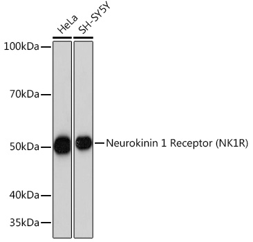 Western blot analysis of various lysates using Neurokinin 1 Receptor (NK1R) (NK1R) Rabbit mAb at 1:1000 dilution.|Secondary antibody: HRP-conjugated Goat anti-Rabbit IgG (H+L) at 1:10000 dilution.|Lysates/proteins: 25μg per lane.|Blocking buffer: 3% nonfat dry milk in TBST.|Detection: ECL Basic Kit.|Exposure time: 3s.