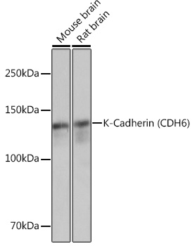 Western blot analysis of various lysates using K-Cadherin (CDH6) Rabbit mAb at 1:3000 dilution.|Secondary antibody: HRP-conjugated Goat anti-Rabbit IgG (H+L) at 1:10000 dilution.|Lysates/proteins: 25μg per lane.|Blocking buffer: 3% nonfat dry milk in TBST.|Detection: ECL Basic Kit.|Exposure time: 1s.