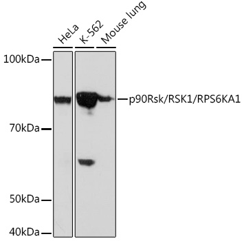 Western blot analysis of various lysates using p90Rsk/RSK1/RPS6KA1 Rabbit mAb at 1:1000 dilution.|Secondary antibody: HRP-conjugated Goat anti-Rabbit IgG (H+L) at 1:10000 dilution.|Lysates/proteins: 25μg per lane.|Blocking buffer: 3% nonfat dry milk in TBST.|Detection: ECL Basic Kit.|Exposure time: 3min.