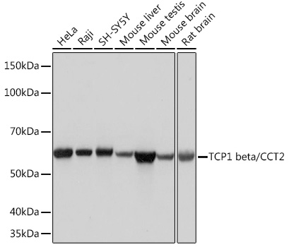 Western blot analysis of various lysates using TCP1 beta/CCT2 Rabbit mAb at 1:1000 dilution.|Secondary antibody: HRP-conjugated Goat anti-Rabbit IgG (H+L) at 1:10000 dilution.|Lysates/proteins: 25μg per lane.|Blocking buffer: 3% nonfat dry milk in TBST.|Detection: ECL Basic Kit.|Exposure time: 3s.