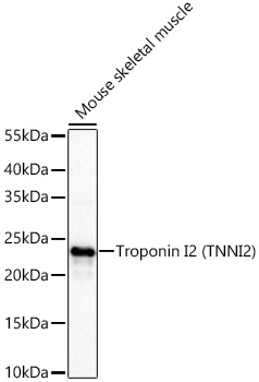 Western blot analysis of lysates from Mouse skeletal muscle using Troponin I2 (TNNI2) Rabbit mAb at 1:1000 dilution incubated at room temperature for 1.5 hours.|Secondary antibody: HRP-conjugated Goat anti-Rabbit IgG (H+L) at 1:10000 dilution.|Lysates/proteins: 25 μg per lane.|Blocking buffer: 3% nonfat dry milk in TBST.|Detection: ECL Basic Kit.|Exposure time: 10 s.